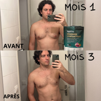 Aquiova | Drainage Lymphatique