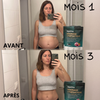 Avant après ventre dégonflé drainage lymphatique femme