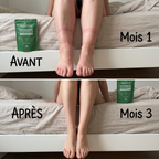 Chevilles dégonflées marques de chaussettes drainage lymphatique